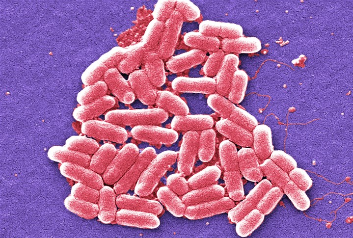 Pennsylvania woman infected with 'superbug' that is antibiotic-resistant