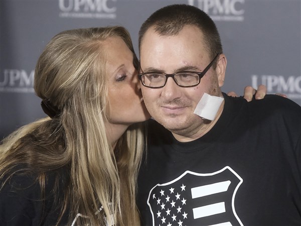 Police chief who lost arm to fireworks married 18 days later